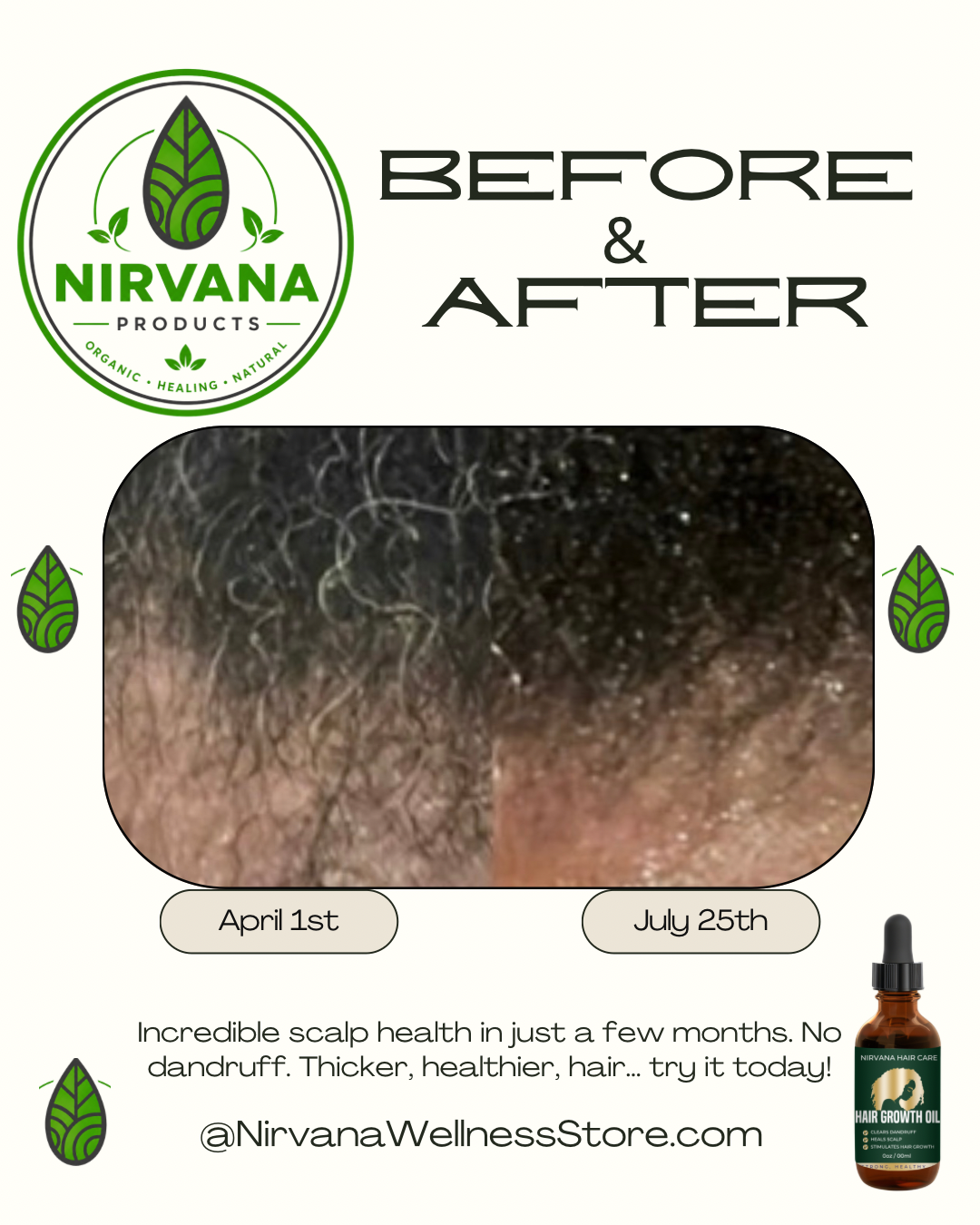 Nirvana Hair Growth Oil - 2oz